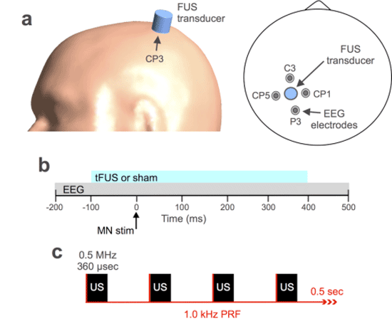 a, The focused ultrasound transducer is shown placed at EEG electrode site CP3 on a model of a human head (left). A top-down schematic (right) illustrates transducer and electrode positioning at international 10-20 EEG electrode site sites C1, CP1, CP5 and P3. b, The timing strategy for delivering transcranial focused ultrasound prior to, during, and following median nerve stimulation is illustrated. c, A schematic illustrates the pulsed ultrasound waveform transmitted from the focused ultrasound transducer. The acoustic frequency of the waveform was 0.5 MHz and the pulse duration was 360 usec (black). The pulse repetition frequency (PRF; red) was 1 kHz for the stimulation duration of 500 msec. (Courtesy Carilion Research Institute)