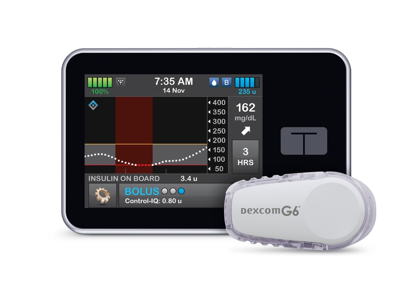 Tandem's New Clearance Strengthens Relationship with DexCom