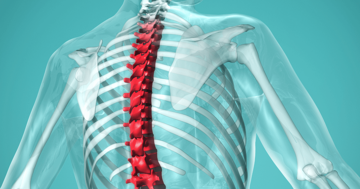 Stryker Goes Spineless