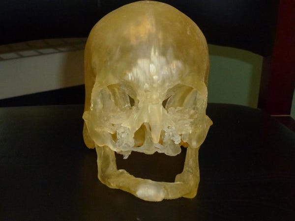 3-D Printing Face Transplant