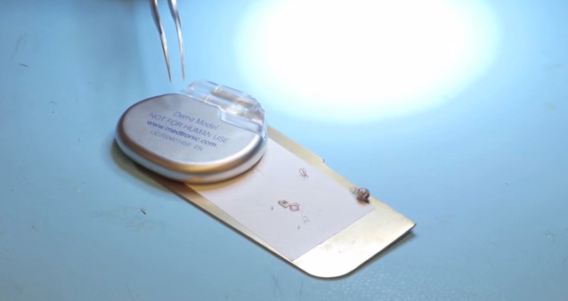 Finally, Real Wireless Power for Miniaturized Implants