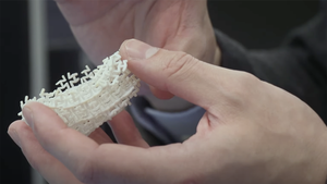 3D-printed implantable lower-limb socket