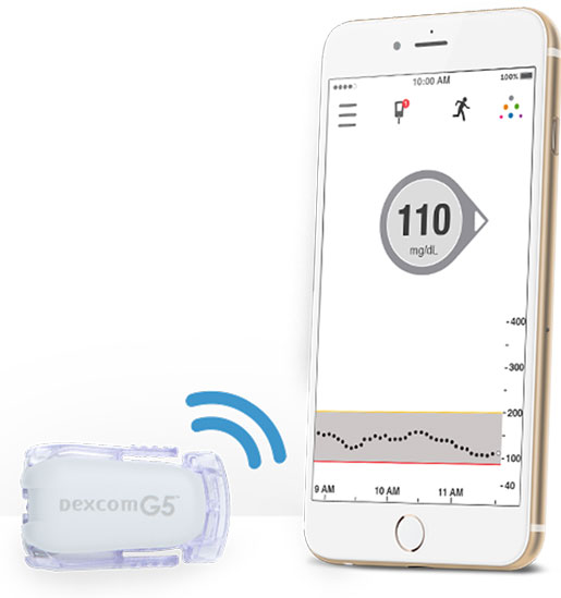 2015 Medtech Company of the Year Finalists: Dexcom