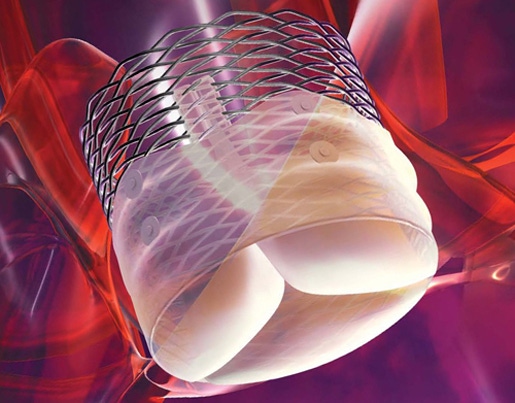 Will Boston Scientific Be Too Late To TAVR Party?