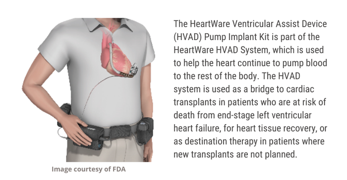 Medtronic HeartWare HVAD System