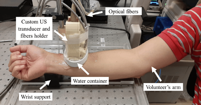 Study: SLSC Photoacoustic Imaging to Reduce Skin Tone Bias
