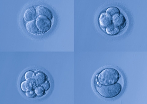 New Imaging Test Aims to Make IVF Less of a Gamble