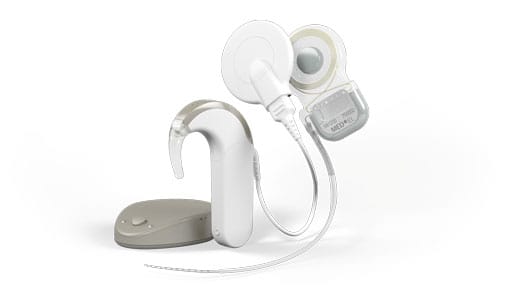 Cochlear Mri Splint Move to 3.0 T MRI Spurs Cochlear Implant Innovation