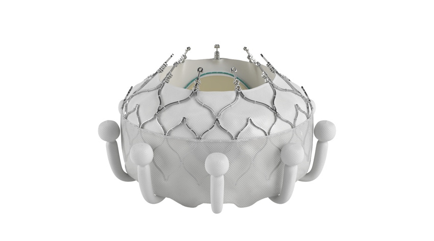 Evoque is the first transcatheter valve replacement therapy to receive regulatory approval to treat tricuspid regurgitation.