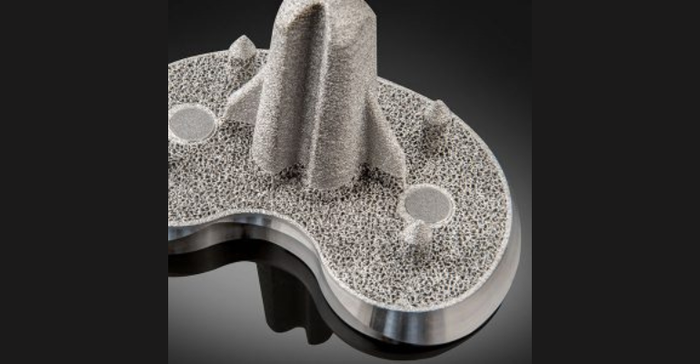 Image of an Exactech porous-coated knee implant that launched in August 2021. The company has been dealing with a massive recall of knee, hip, and ankle implants due to a medical device packaging issue.