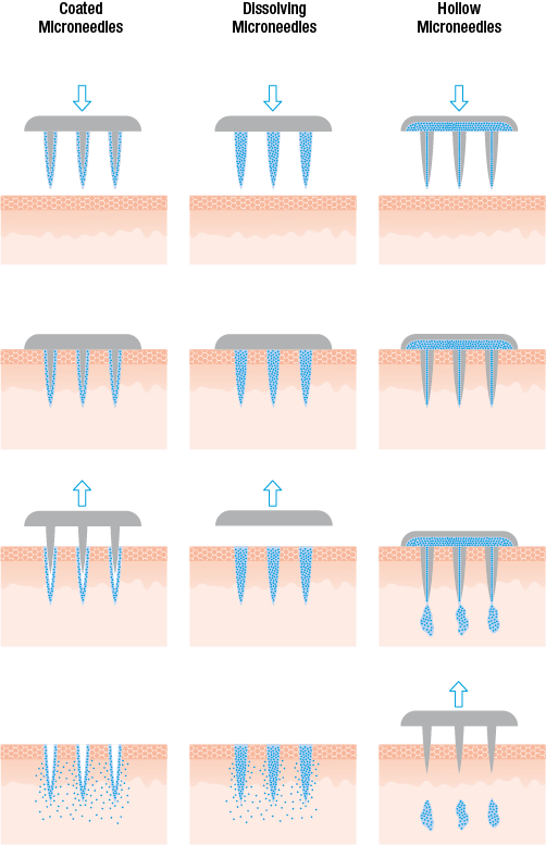 Microneedles_transparent.png