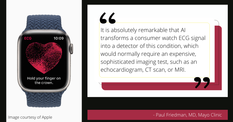 No ecg app on apple online watch 4