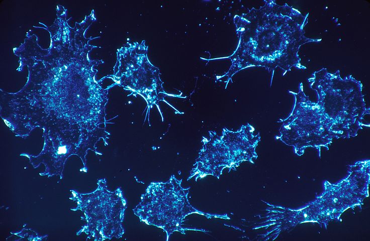 Using AI to Get a Better Understanding of Cancer Cells