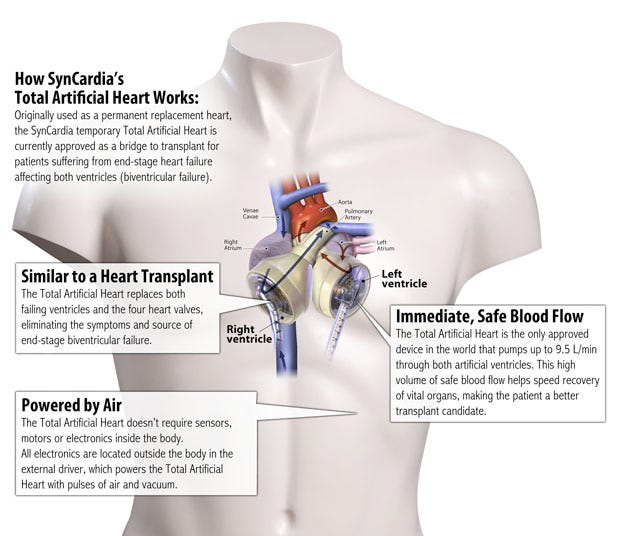 A diagram showing how the SynCardia Total Artificial Heart, which uses segmented polyurethane as a key material, works.