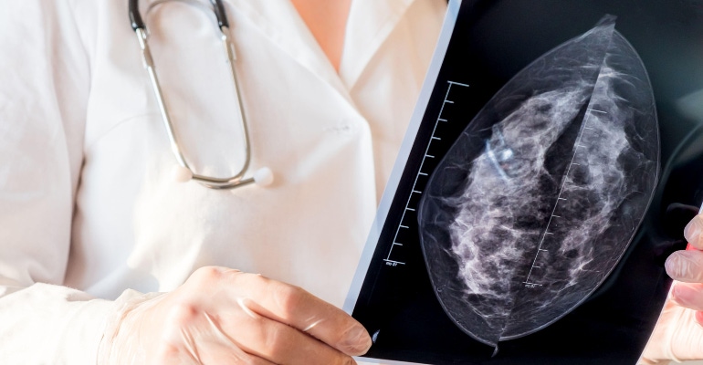 female doctor looking at breast screening mammography results
