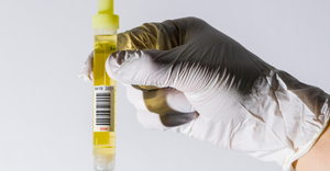 a lab assistant's gloved hand holds a urine sample.