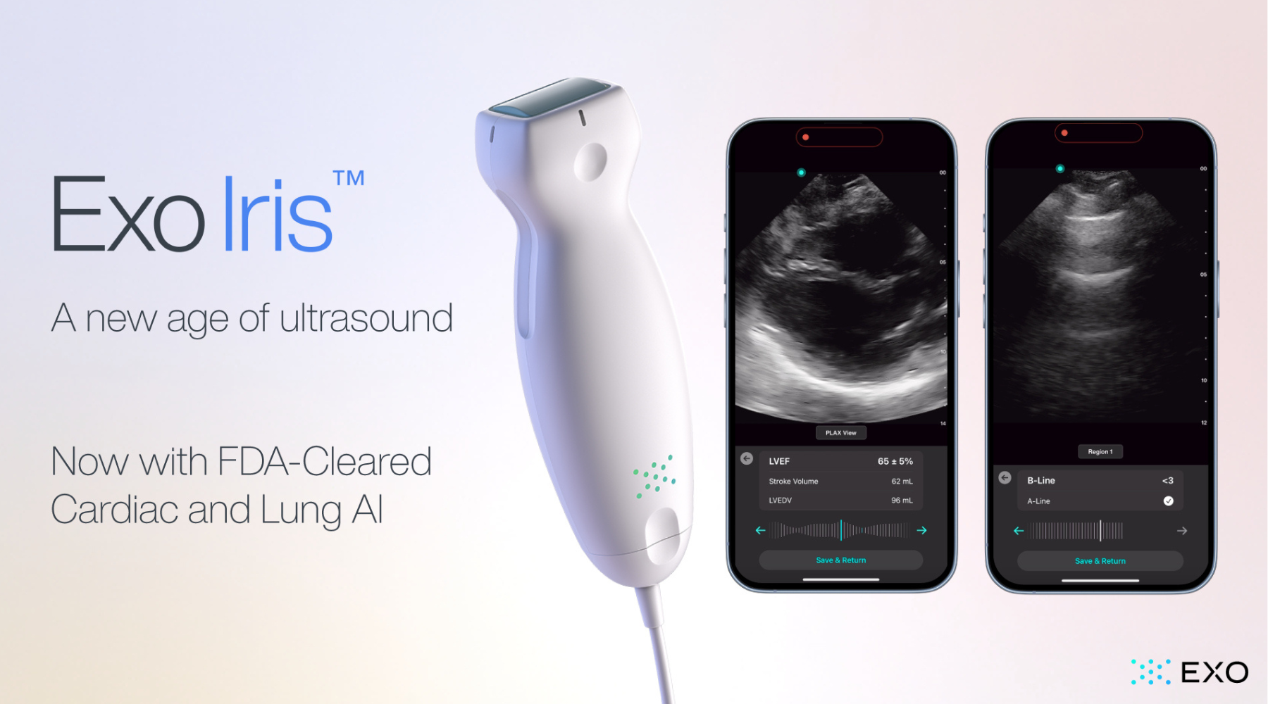 Exo’s FDA Cleared Cardiac &amp; Lung AI Now on Iris Handheld
Ultrasound
