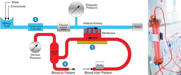 Dialysis machines require highly-accurate pressure measurements of the patient's blood pressure and the dialysate fluid which clears toxins from their bloodstream. 