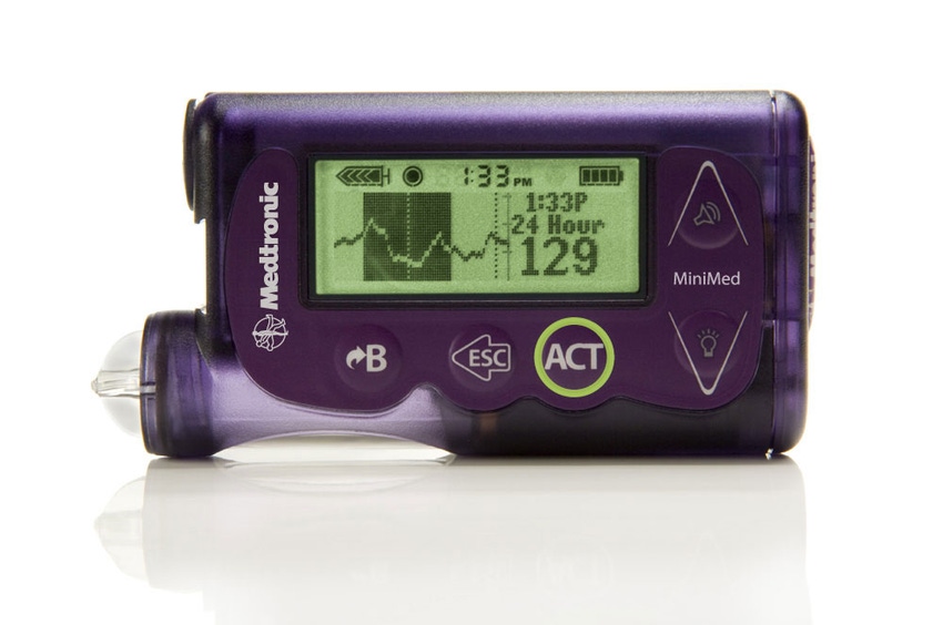 Is Medtronic’s First-Gen Artificial Pancreas Really a Game Changer?