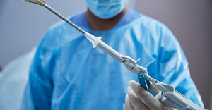 A surgeon holds Hologic's NovaSure V5 endometrial ablation device.