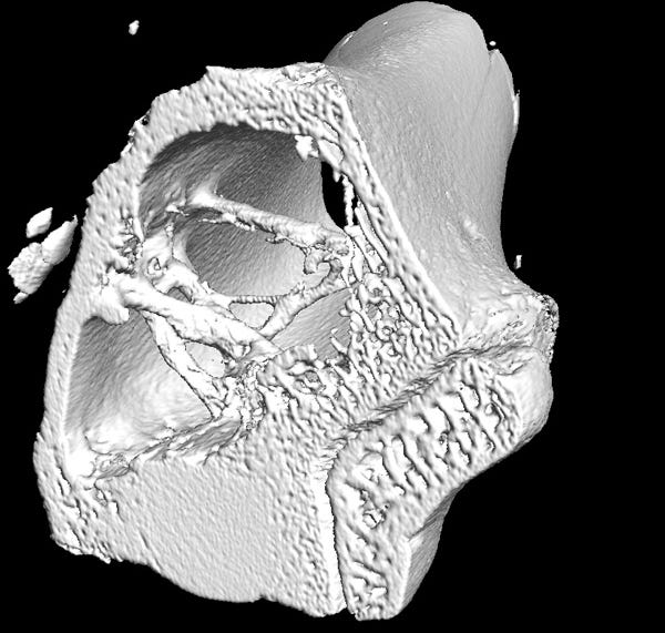 Penn State biomaterials micro CT implants in bone