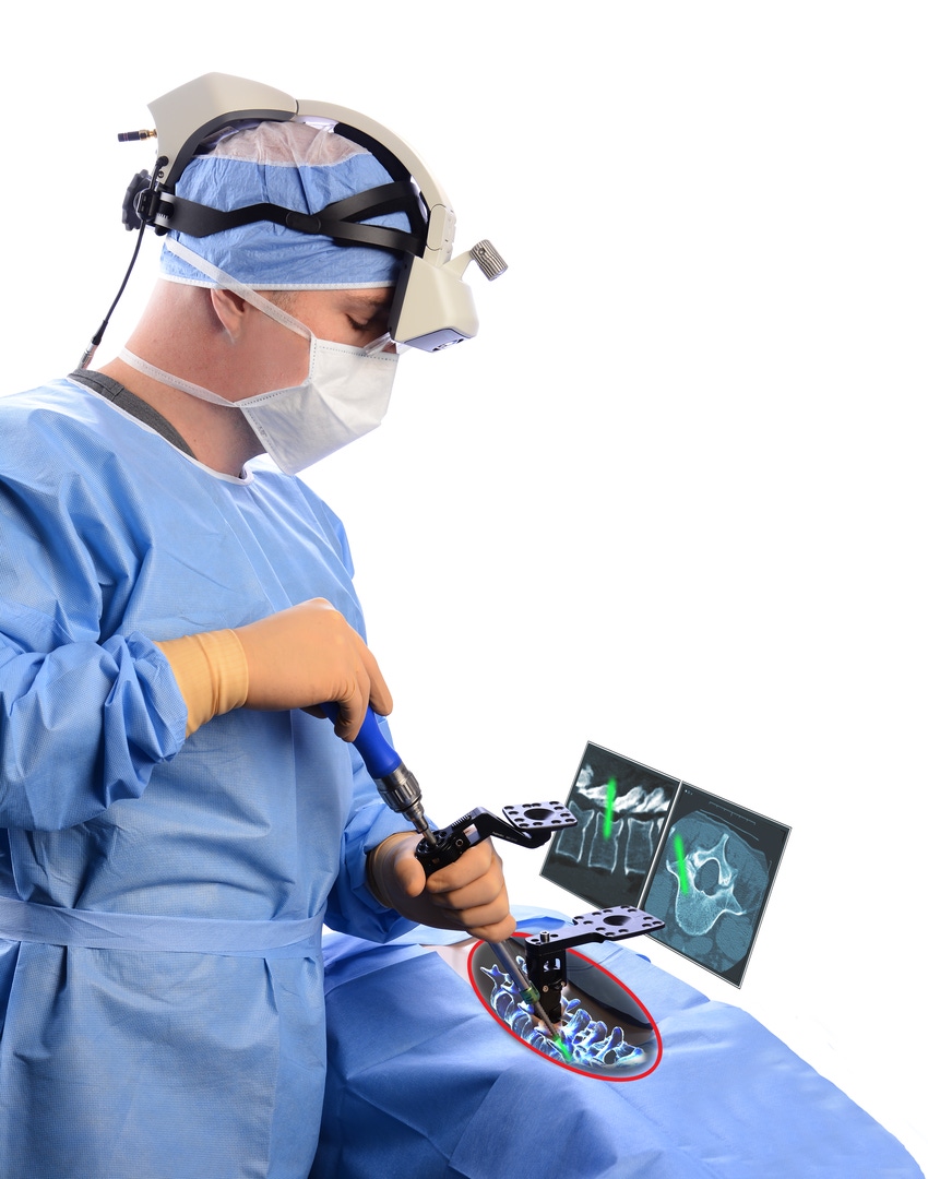 Augmenting the Spine Surgeon’s Reality