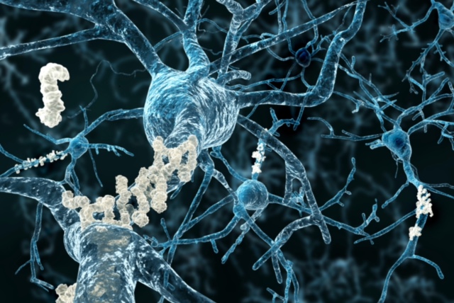 Roche Lands Breakthrough Designation for Alzheimer’s Test
