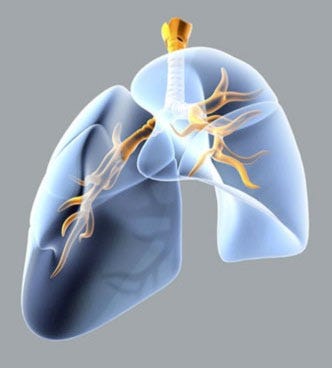 Denervation treatment is set for clinical trials for COPD. (Courtesy Holaira Inc.)