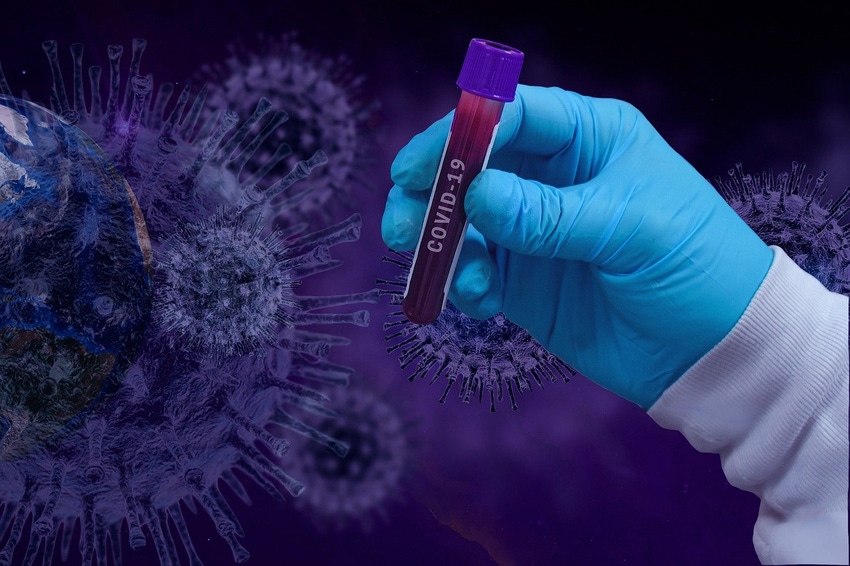 FDA Warns of COVID-19 Antibody Testing Limitations