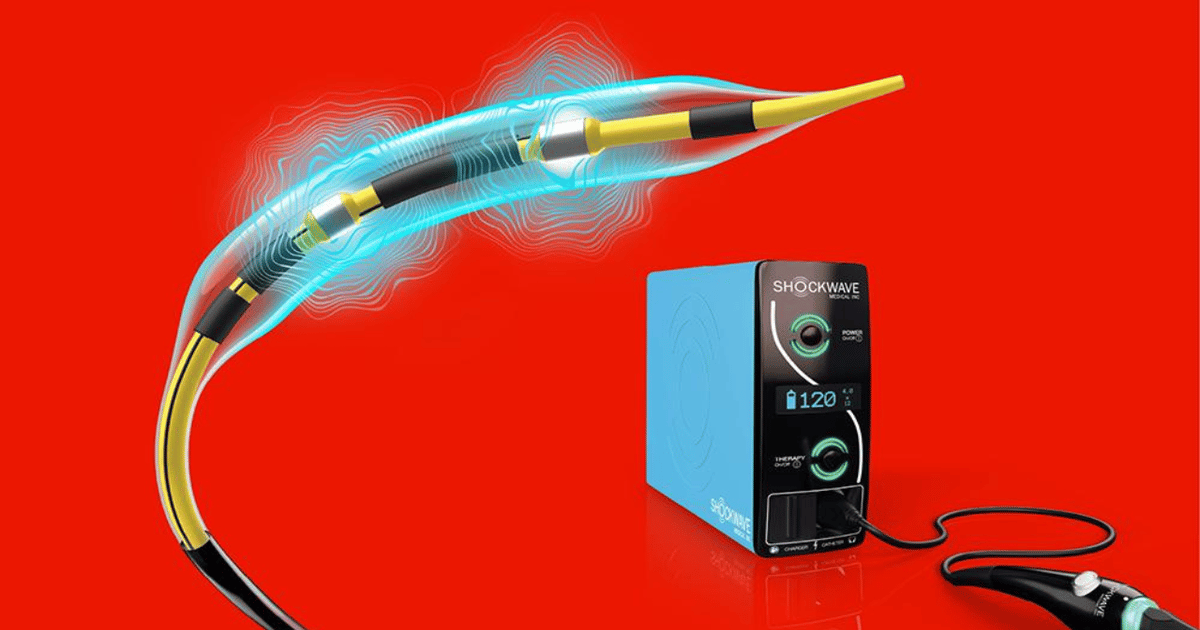 Shockwave's Latest Catheter to Speed Up Growing Cath Lab Volumes