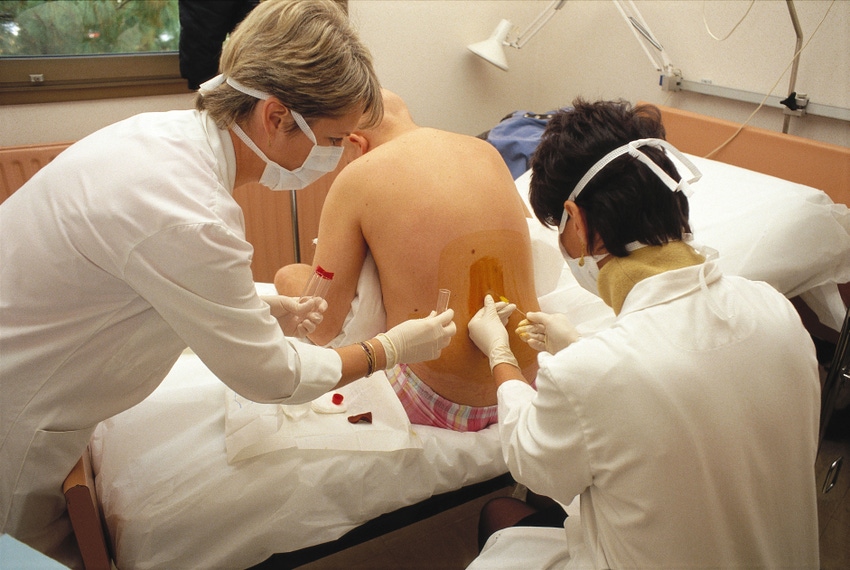 physicians performing a spinal tap on a patient