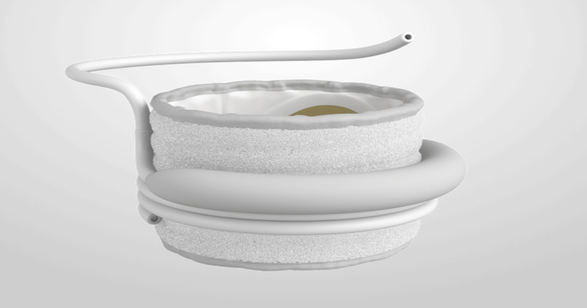 Edwards Lifesciences Recalls SAPIEN M3 Valves After Patient Death