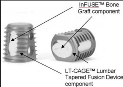 Infuse LT cage