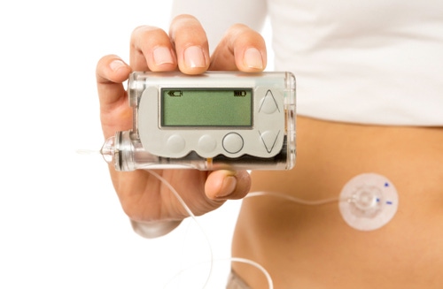 New Technology Aims to Make Insulin Pumps More Reliable