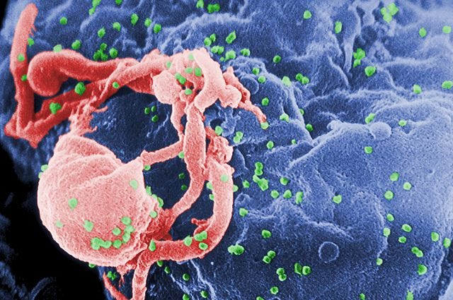 HIV color photograph