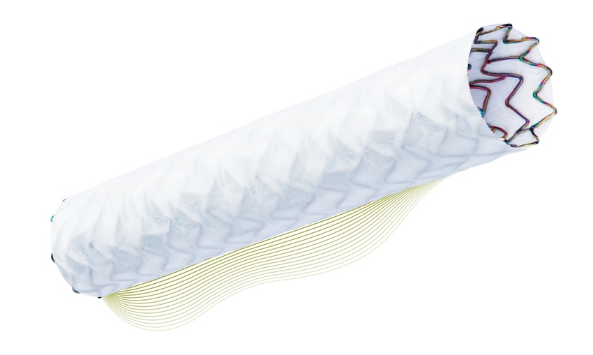 Biotronik Is a Tougher Competitor in Stents with PK Papyrus