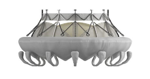 Transcatheter Mitral Valve Replacement Set for CE Mark Trial