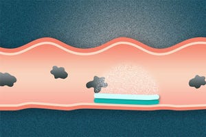 New Material Can Stick It out in GI Tract