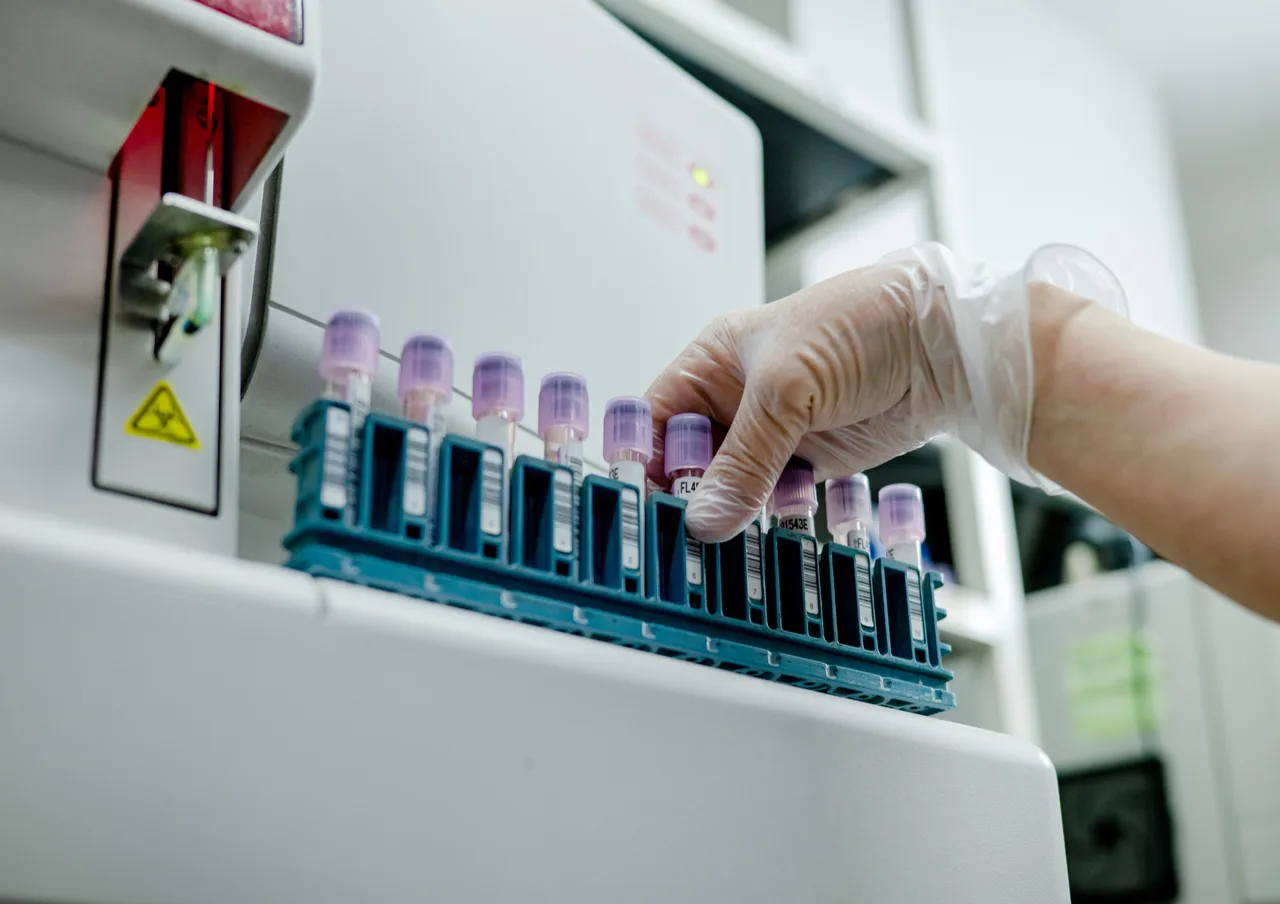 Lab Testeing CMS Proposes 16% Cut to Medicare Lab Test Rates