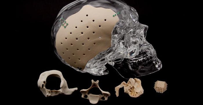 3D printing company Oxford Performance Materials has developed a line of 3D printed medical implants including a cranial implant, a facial implant, and suture anchors.