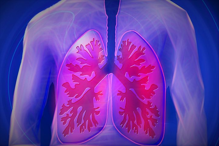 Nuvaira Raises $79M for COPD Treatment Device