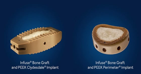 Medtronic Expands Use of Controversial Infuse Product