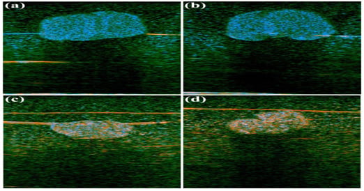 New Color Format Could Boost Ultrasound