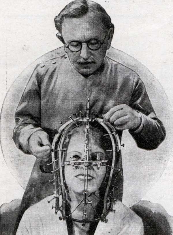 10 Scary Antique Medical Devices for Halloween