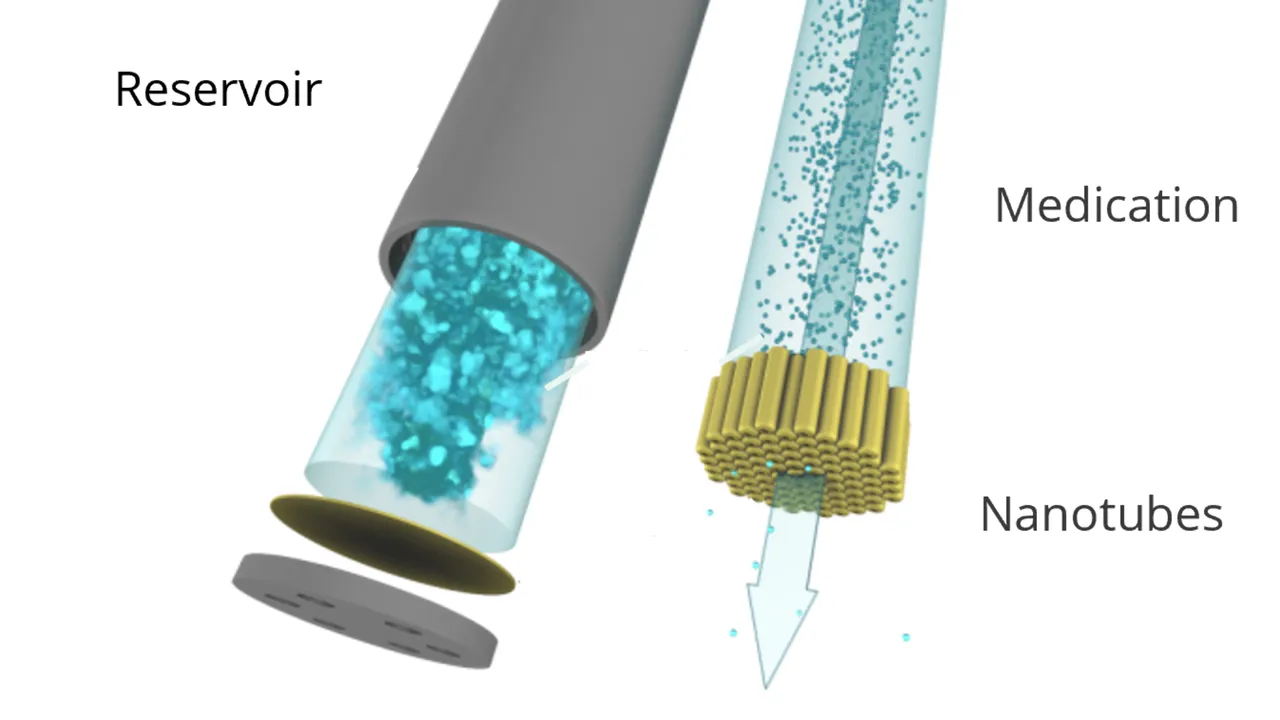 Vivani Medical's GLP-1 Implant Aims to Improve Adherence Vivani Medical's GLP-1 Implant Aims to Improve Adherence