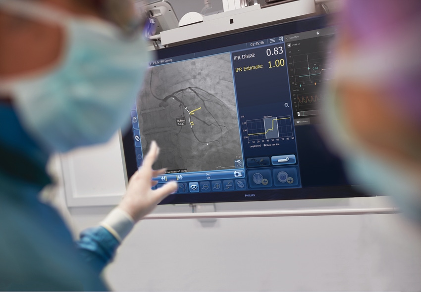 Philips Seeks Better Understanding of PCI Outcomes Through New Trial