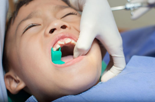 Top Medtech News Stories of 2015: FDA's Dental Amalgam Stance