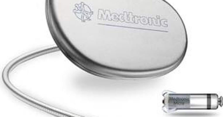 Are Leadless Pacemakers Effective for Children with Bradycardia?