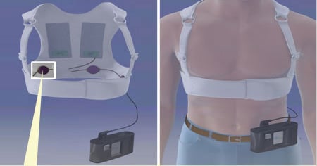 Wearable Defib Vest Shows Promise, Says AHA