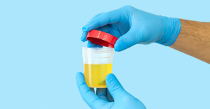 urine sample for electroanalytical testing in a clinical setting.png